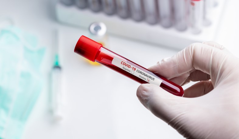 Վրաստանում գրանցվել է կորոնավիրուսով վարակման 228 նոր դեպք