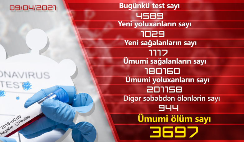 Ermənistanda koronavirusa1029  yoluxma qeydə alınıb, 1117 nəfər sağalıb