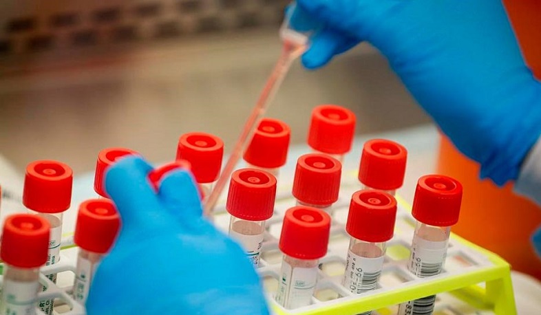 В Арцахе выявлено 2 случая заболевания коронавирусом