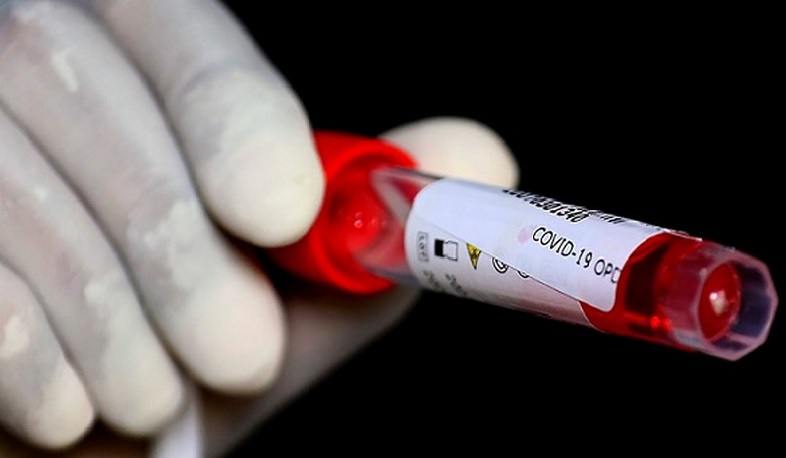 Վրաստանում կորոնավիրուսի նոր դեպքերը 1374 են