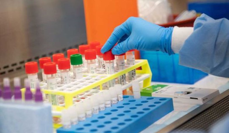 ԵԱՏՄ որոշմամբ բժշկական նշանակության սարքավորումների և նյութերի առանձին տեսակներ ազատվել են մաքսատուրքից