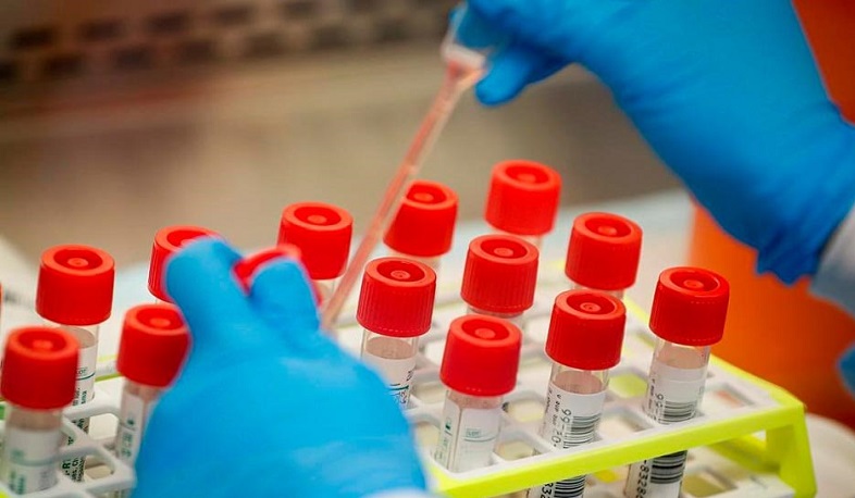 Արցախում հաստատվել է կորոնավիրուսի 4 նոր դեպք