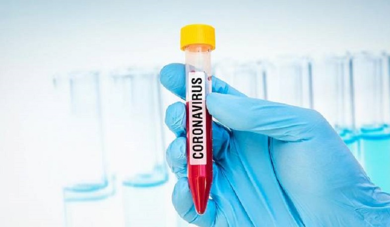 В Арцахе выявлено 4 случая заболевания коронавирусом