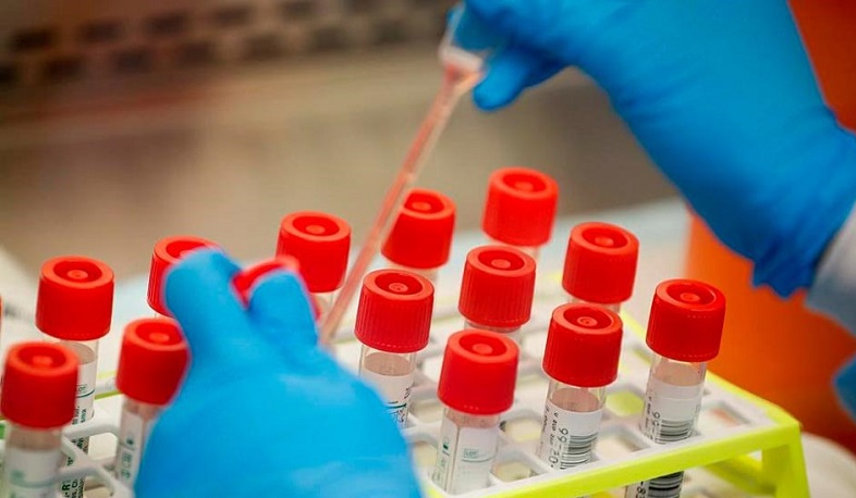 В Арцахе выявлено 3 случая заболевания коронавирусом