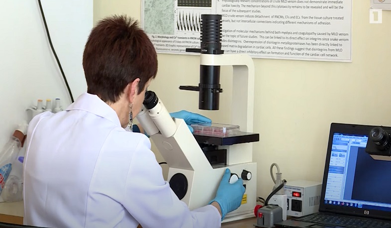 Հայաստանում ուսումնասիրվում է մարդու մաշկի ստեղծման հնարավորությունը