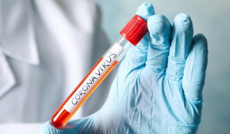 В Арцахе выявлено 2 случая заболевания коронавирусом