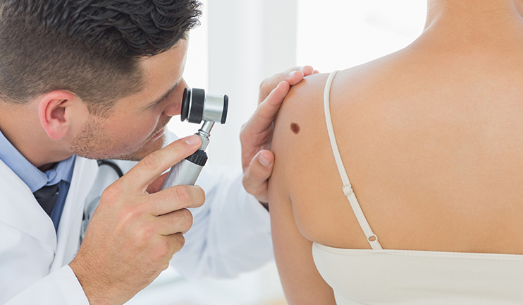 Առողջ առավոտ. Մելանոմա