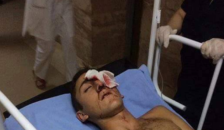 Խորենացի փողոցի և Սարի թաղի բախումների հետևանքով հիվանդանոց է տեղափոխվել 60 մարդ