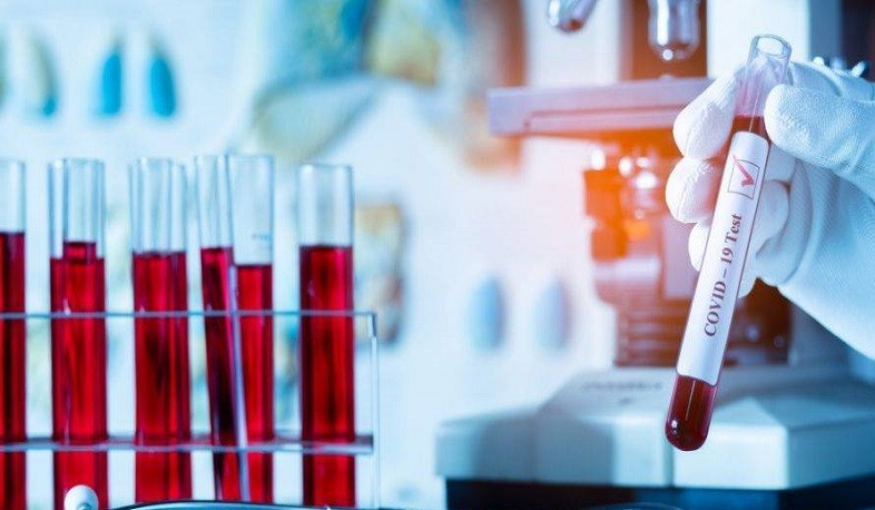 Վրաստանում արձանագրվել է կորոնավիրուսով վարակման 2261 նոր դեպք