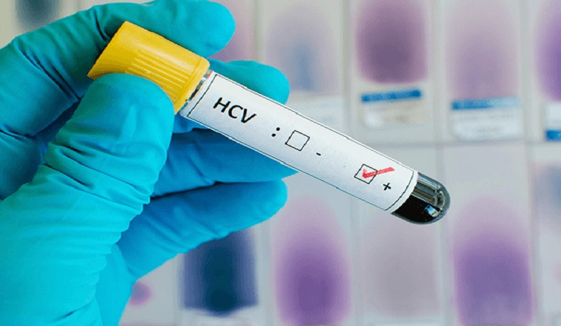 2020-ին Հայաստանում արձանագրվել է հեպատիտների 1244 դեպք