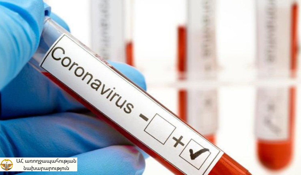 Արցախում կորոնավիրուսի 5 նոր դեպք է գրանցվել