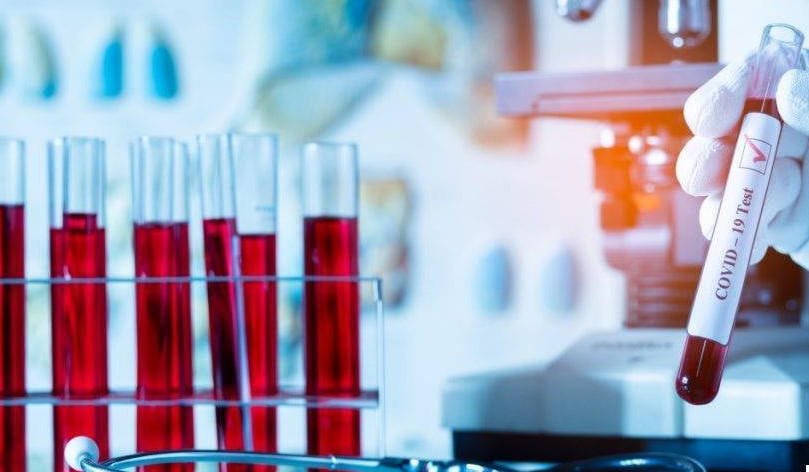 Արցախում կորոնավիրուսի նոր դեպք չի գրանցվել