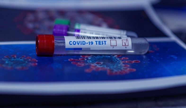 30 նմուշառված դեպքերից Հայաստանում գրանցվել է 5 բրիտանական շտամի և 25 «դելտա» շտամի առկայություն