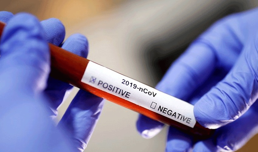 В Арцахе выявлено 10 случаев заболевания коронавирусом