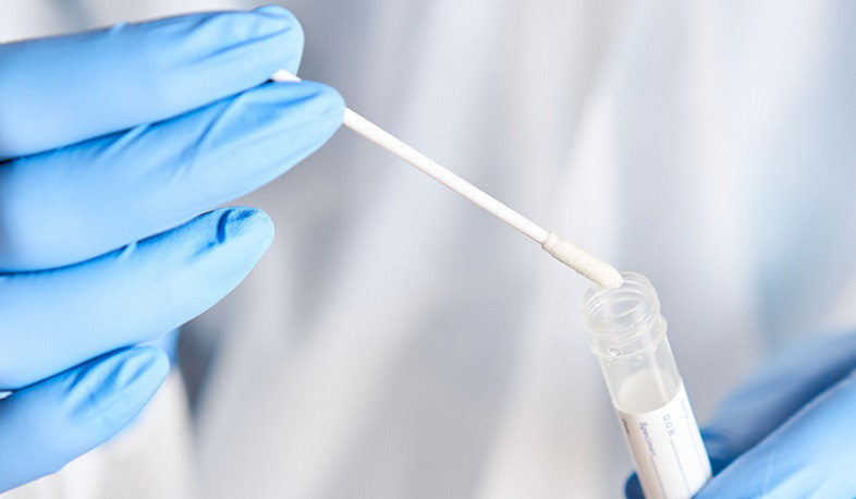 Մեր փորձագետների խումբն աշխատում է 14-օրյա թեստավորման պարբերականությունը կրճատելու ուղղությամբ. Ավանեսյան