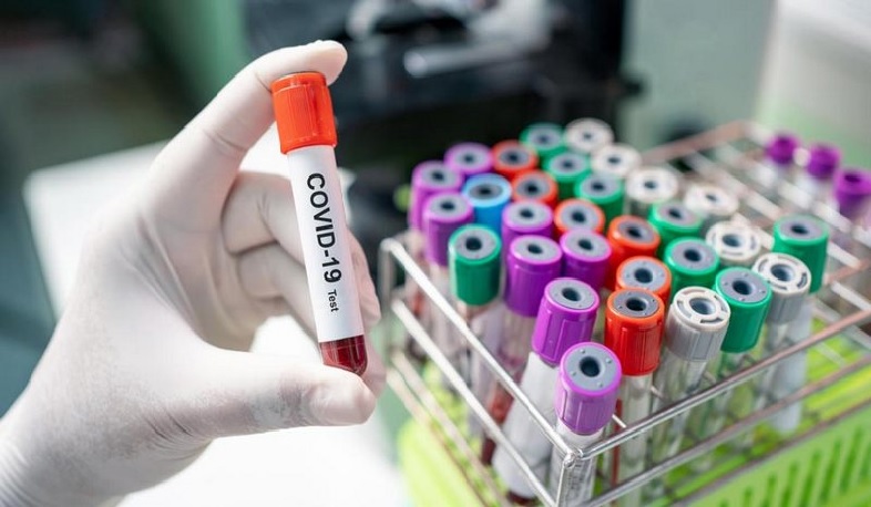 В Грузии выявлено 4610 случаев заражения коронавирусом