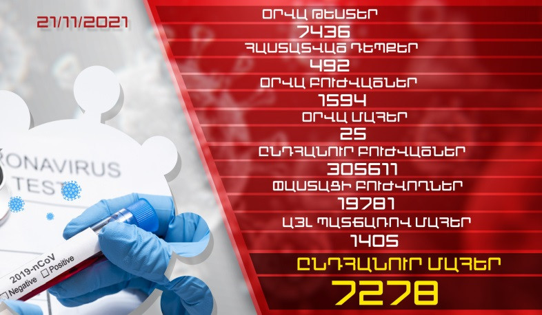 Թարմացում. 21.11.2021. Հաստատվել է կորոնավիրուսի 492 նոր դեպք, առողջացել է 1594 քաղաքացի