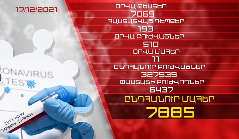 Թարմացում. 17.12.2021. Հաստատվել է կորոնավիրուսի 193 նոր դեպք, առողջացել է 510 քաղաքացի