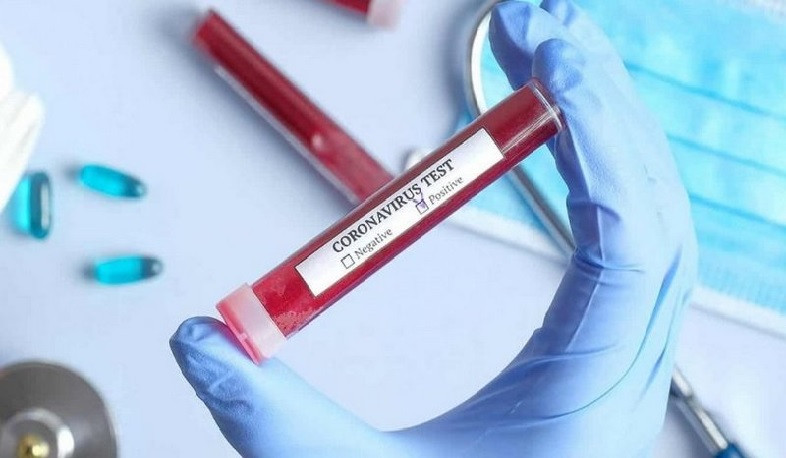 Gürcüstanda koronavirusa 1 976 yeni yolxuma faktı qeydə alınıb