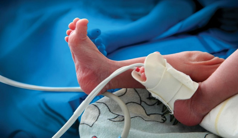 Armenia is one of few countries that has achieved the Sustainable Development Goals for the Prevention of Infant Mortality