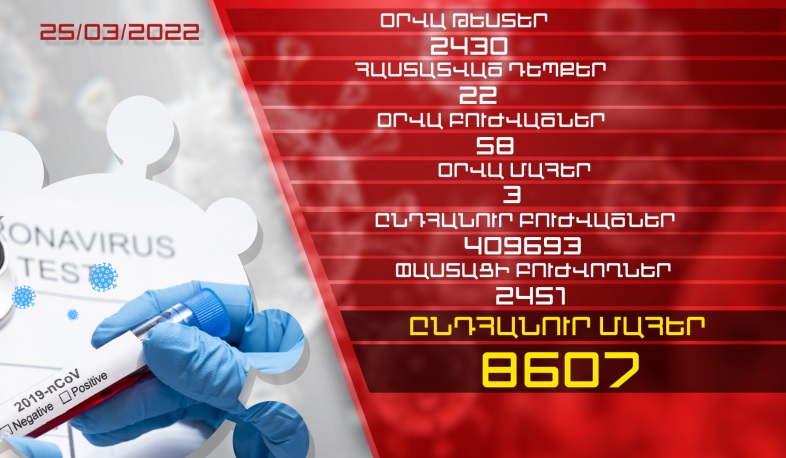 Թարմացում. 25.03.2022. հաստատվել է կորոնավիրուսի 22 նոր դեպք, առողջացել է 58 քաղաքացի