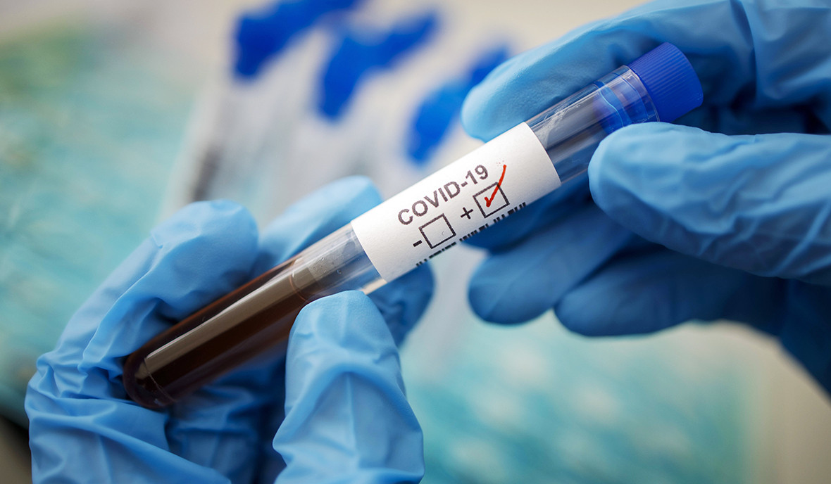 ԵԱՏՄ երկրների քաղաքացիներն ապրիլի 1-ից կարող են Ռուսաստան մուտք գործել՝ առանց կորոնավիրուսի թեստ հանձնելու