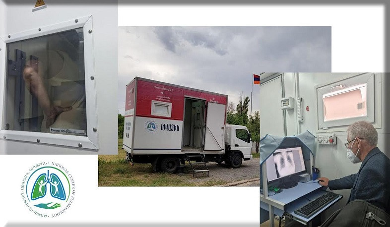 Հոգեկան առողջության պահպանման կենտրոնի 350 պացիենտ հնարավորություն է ստացել անցնելու ֆլյուորոգրաֆիկ հետազոտություն