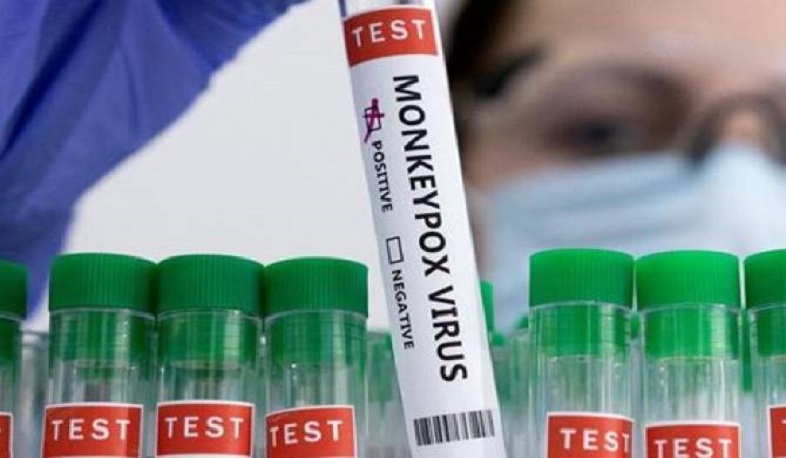 В Грузии подтвержден первый случай оспы обезьян