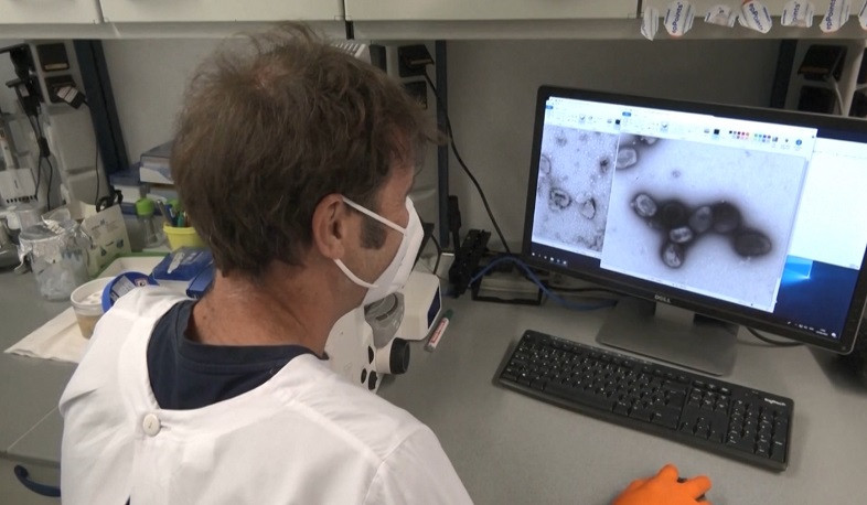 Armenia received two monkeypox diagnostic test kits from Russia