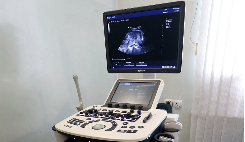 Երևանի 8 բուժհաստատություն համալրվել է ուլտրաձայնային ստացիոնար հետազոտության սարքավորումներով