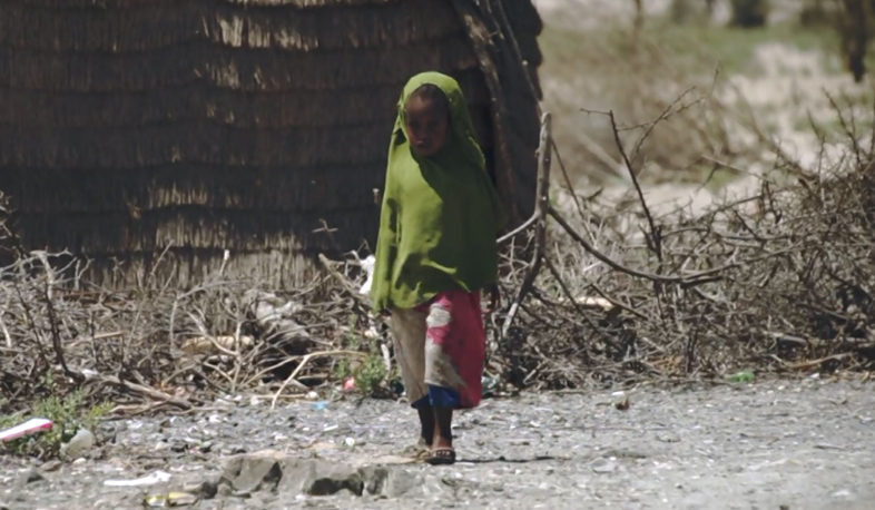 Եմենում խոլերայի համաճարակ է