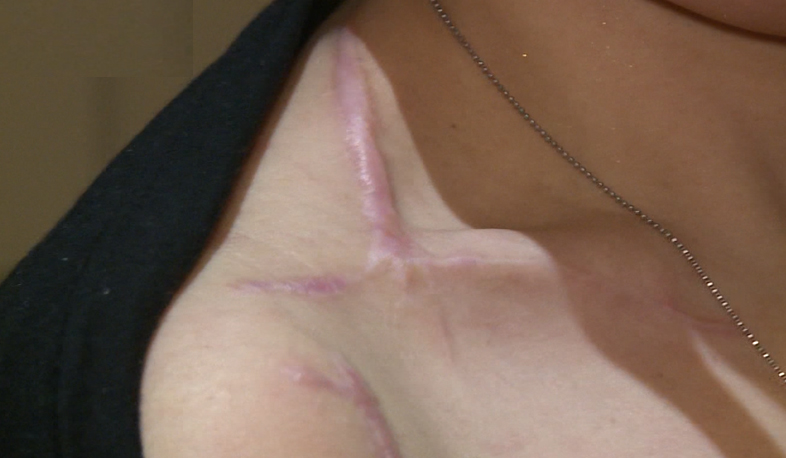 Սոցցանցերում կանանց ակտիվություն, փողի սղություն, միգրացիա... ընտանեկան բռնության պատճառները