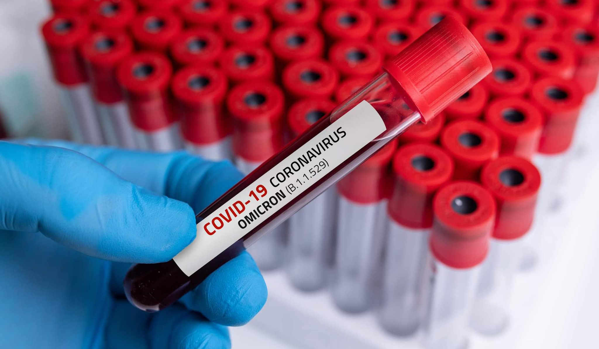 Həftə ərzində Ermənistanda daha 2575 nəfər koronavirusa yoluxub