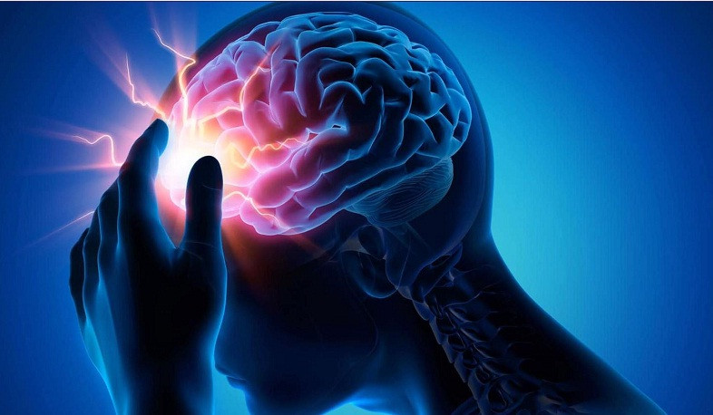 Հոկտեմբերի 28-ը Գլխուղեղի կաթվածի դեմ պայքարի համաշխարհային օրն է