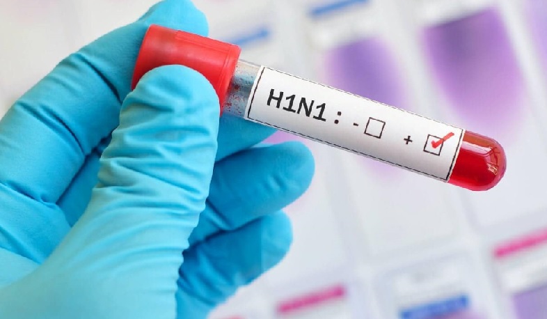 Հայաստանում հաստատվել է գրիպի Ա տեսակի H1N1 ենթատեսակի վիրուսի հարուցիչ
