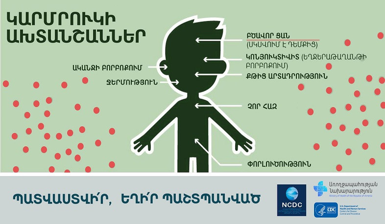 Իրականացվում են հետազոտություններ՝ երկիր ներթափանցած կարմրուկի հետագա տարածումը կանխելու նպատակով. ԱՆ