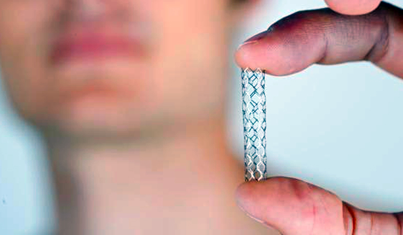 Սրտի ստենտավորման գինն իջեցնելու քայլեր