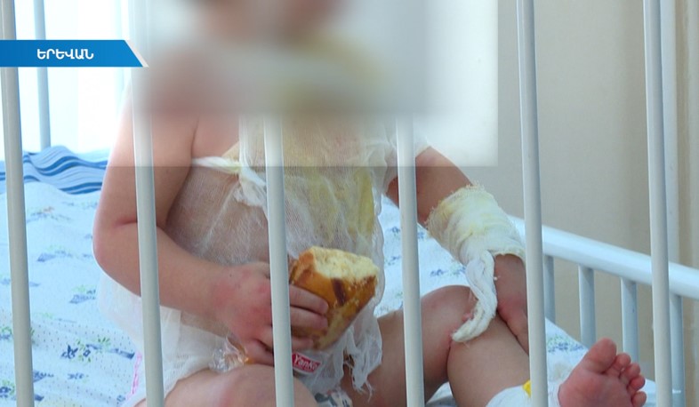 Այրվածքներով փոքրիկն ապաքինվում է