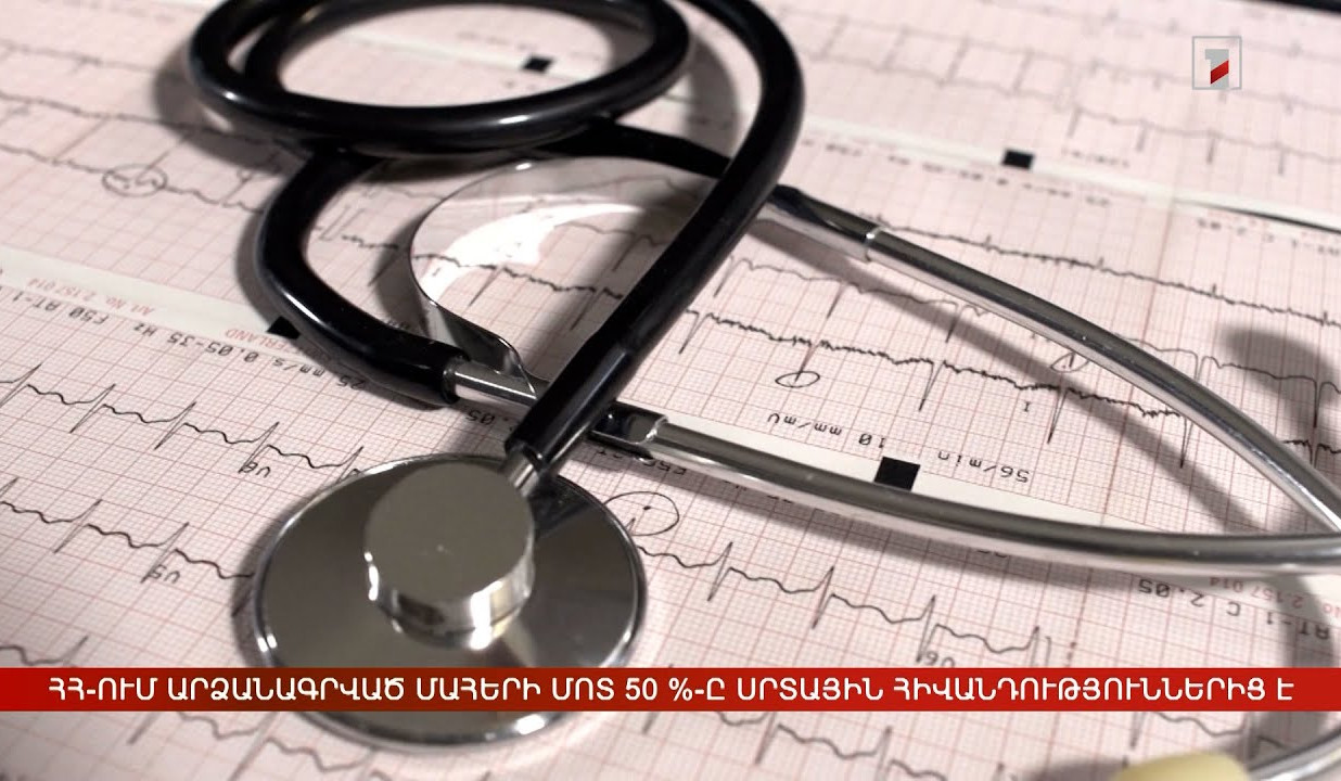 Հայաստանում արձանագրված մահերի մոտ 50 %-ը սրտային հիվանդություններից է