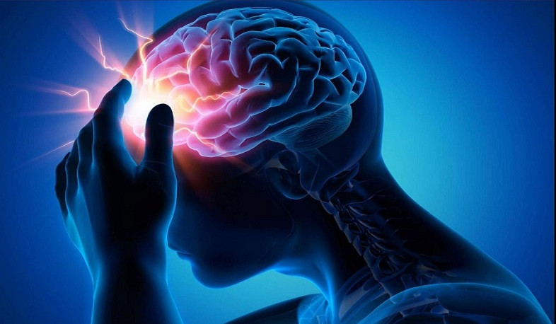 Գլխուղեղի կաթվածի դեմ պայքարի օրն է. մինչև այս տարվա սեպտեմբեր 4113 քաղաքացու համար պետբյուջեից հատկացվել է 8.6 մլրդ դրամ