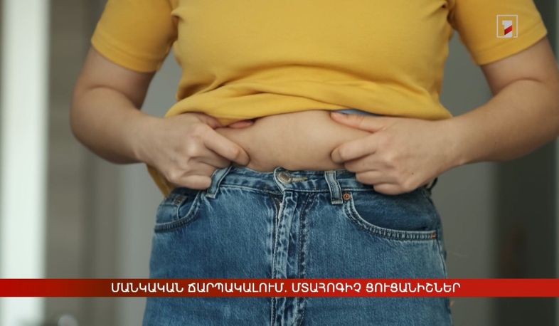 Մանկական ճարպակալում. մտահոգիչ ցուցանիշներ
