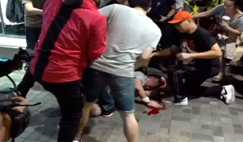 Դաժանության դրսևորումներ Հոնկոնգի հանրահավաքներում