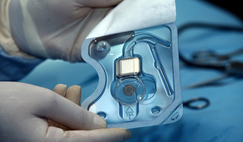 Պետական աջակցություն՝ կոխլեար իմպլանտ կրող մարդկանց