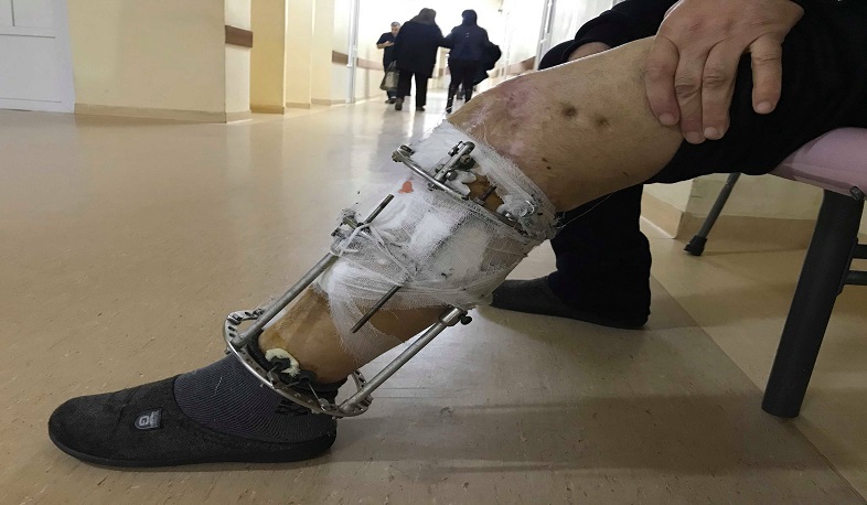 Ամբողջությամբ վերականգնվել է կտրված ոտքը