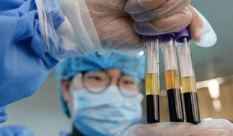 Նուբար Աֆեյանի ընկերությունը ստեղծել է կորոնավիրուսի դեմ պատվաստանյութ. Time