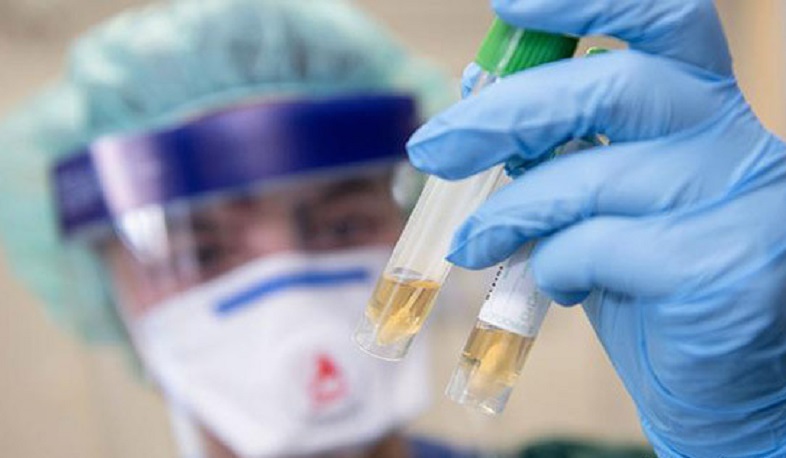 Հայաստանում իրականացվել է նոր կորոնավիրուսի 120 հետազոտություն՝ մեկ դրական արդյունքով. ԱՆ