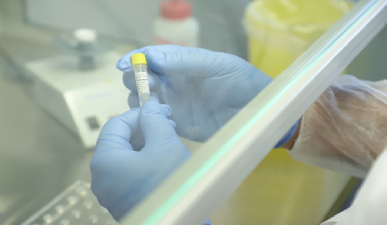 12 մլրդ դոլար՝ կորոնավիրուսի դեմ պայքարի համար. ՀԲ