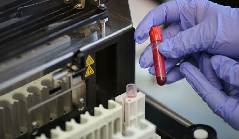 Արցախում կորոնավիրուսի դեպք չի արձանագրվել