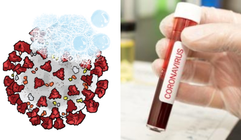 Ի՞նչ է կորոնավիրուսը և ինչպե՞ս պաշտպանվել