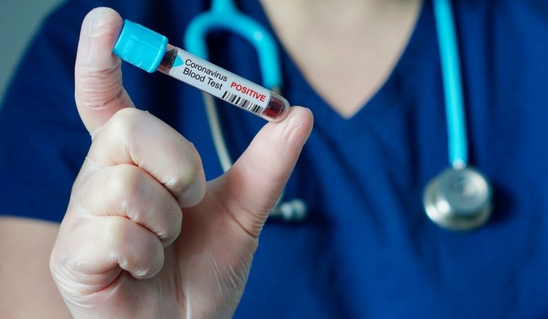 Կորոնավիրուսին առնչվող հաճախ տրվող հարցերի պատասխանները